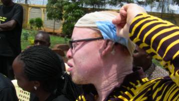 Isaac Mwaura showing his injuries to the members of the press.